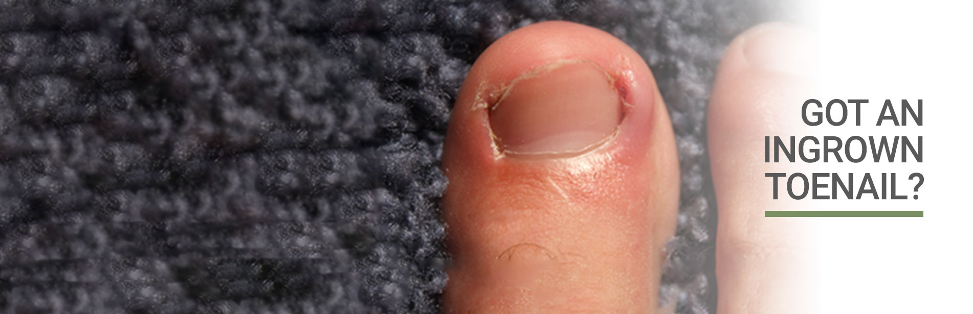 slide-ingrown-toenail