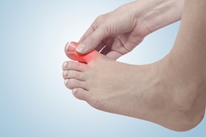 What Is Hallux Limitus?